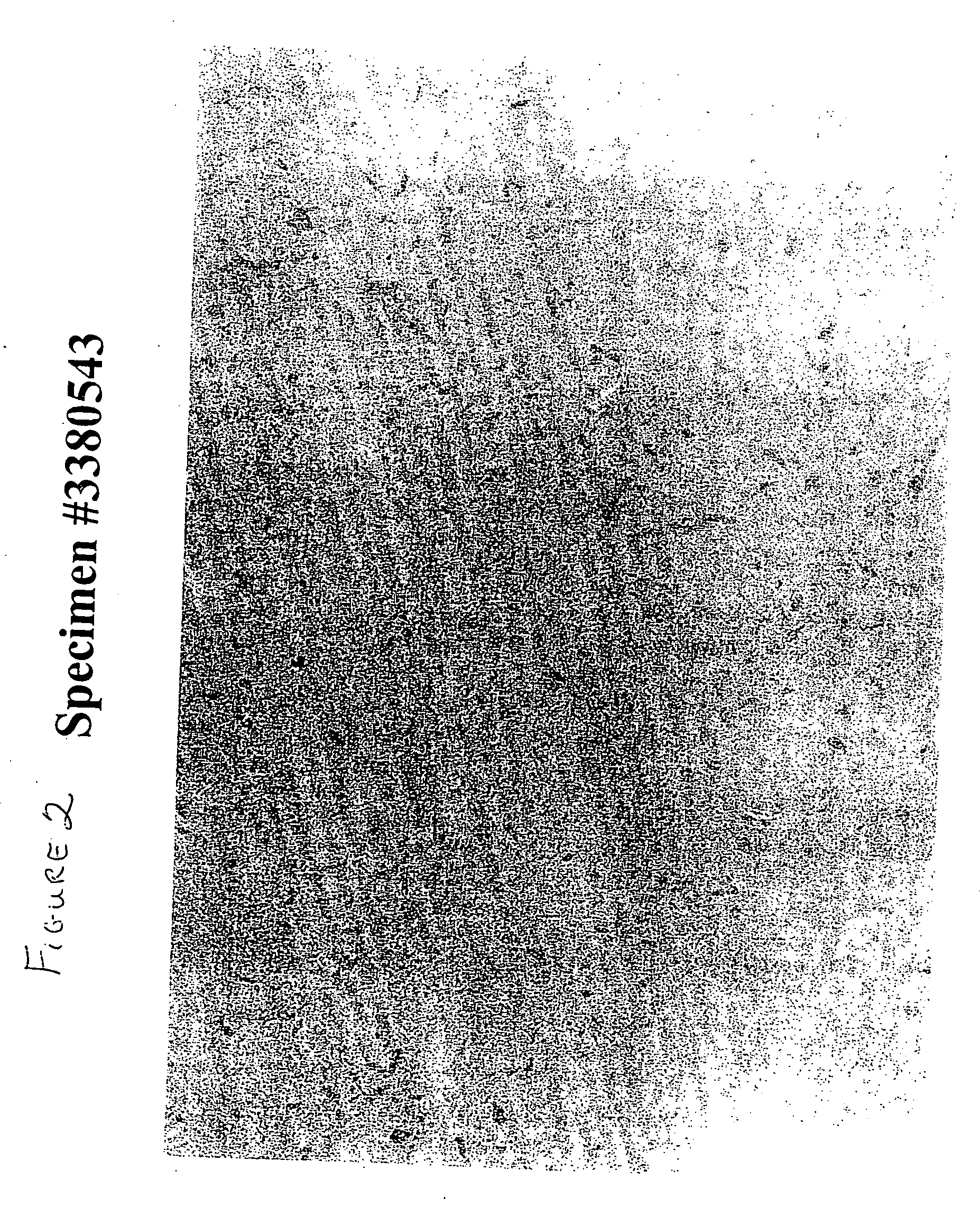 Composition for stabilizing corneal tissue during or after orthokeratology lens wear