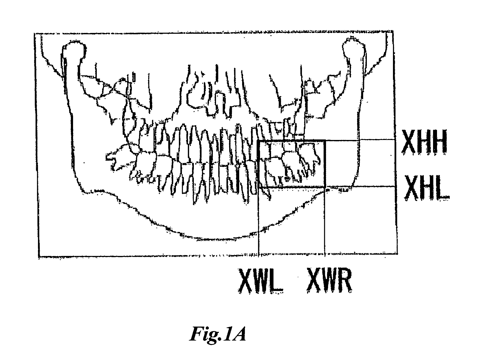 Medical X-ray apparatus