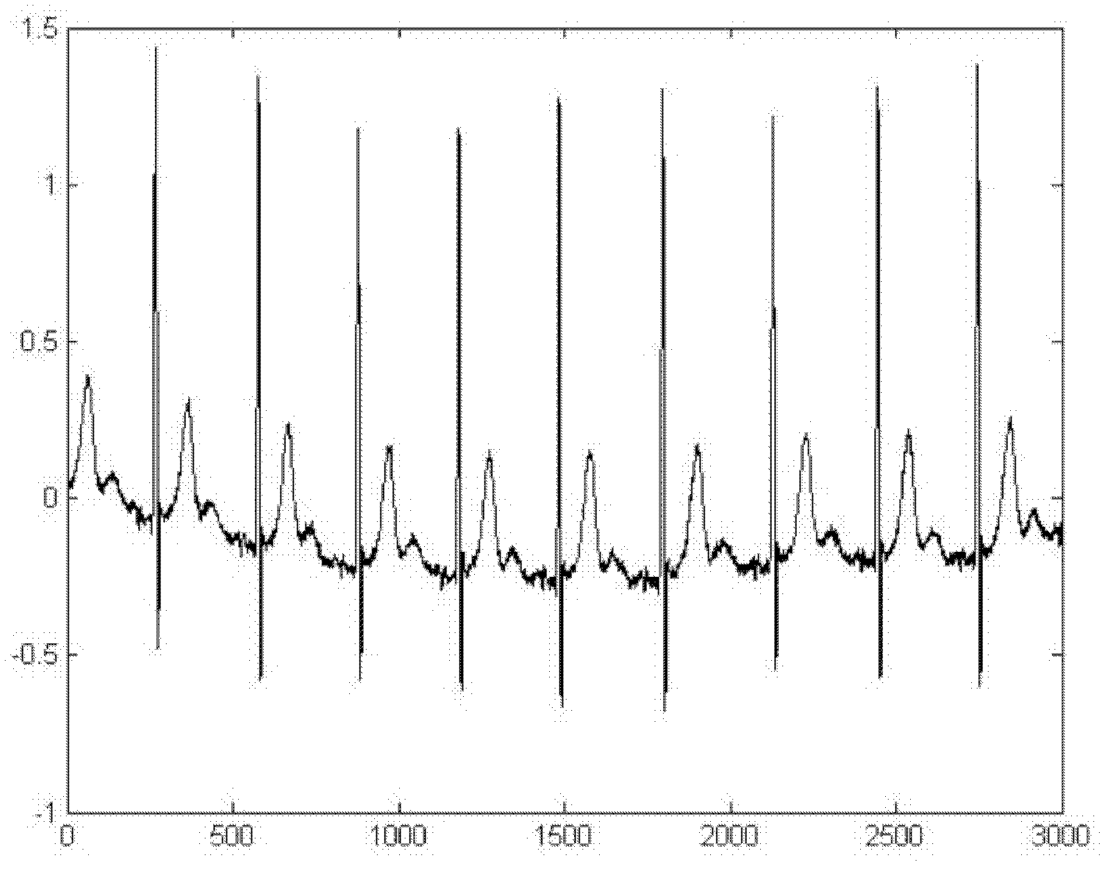 Electrocardiogram baseline drifting correction method based on robust estimation and intrinsic mode function