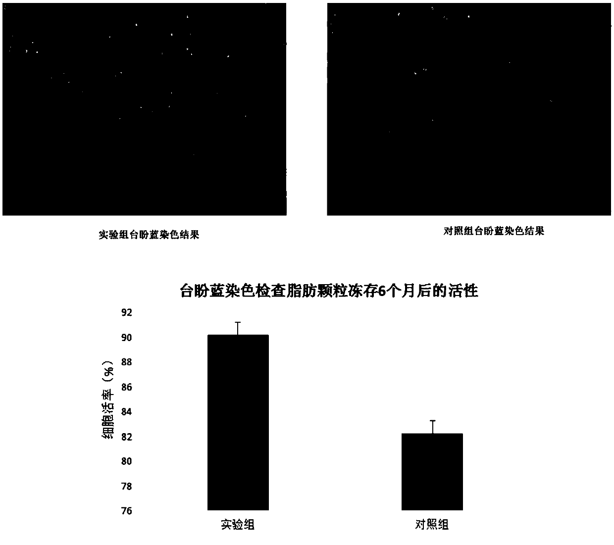 Fat particle tissue cryopreservation liquid, preparation method and freeze-saving method thereof