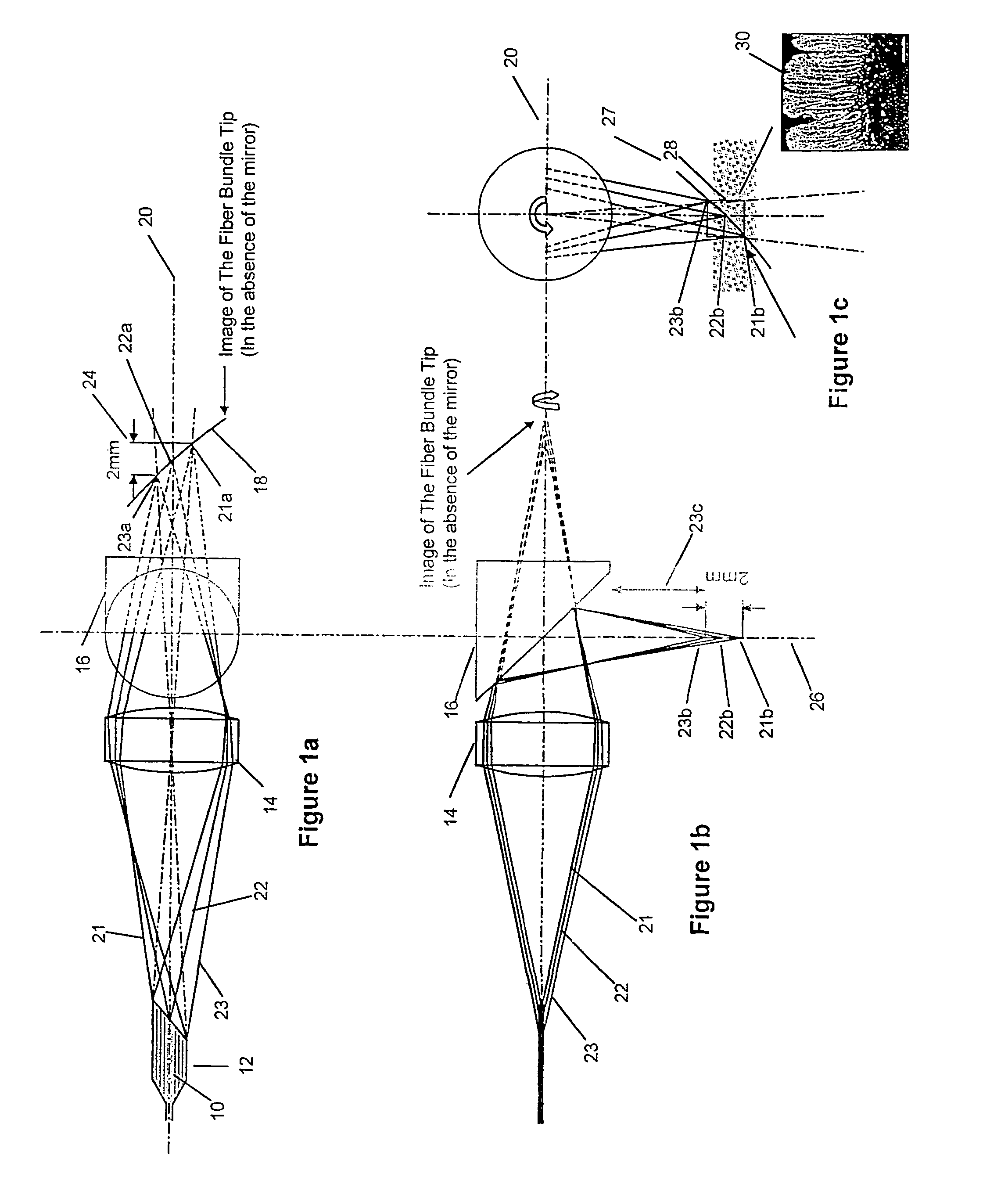 Method and apparatus for high resolution coherent optical imaging