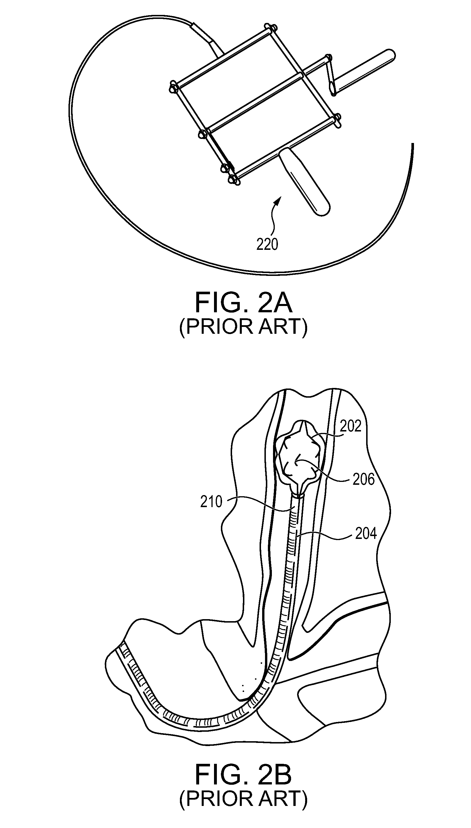 Handle for lithotripsy basket device