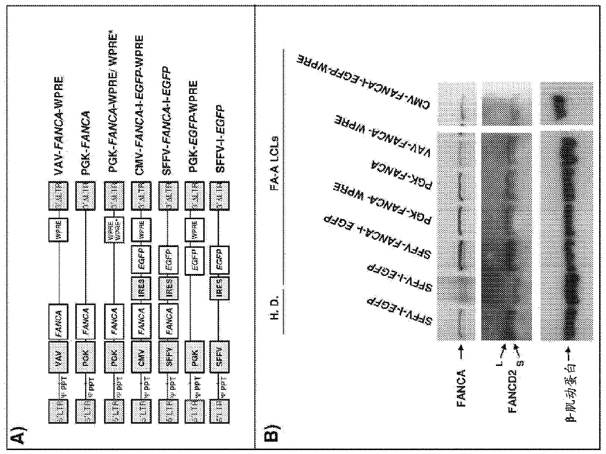 Gene therapy for patients with fanconi anemia