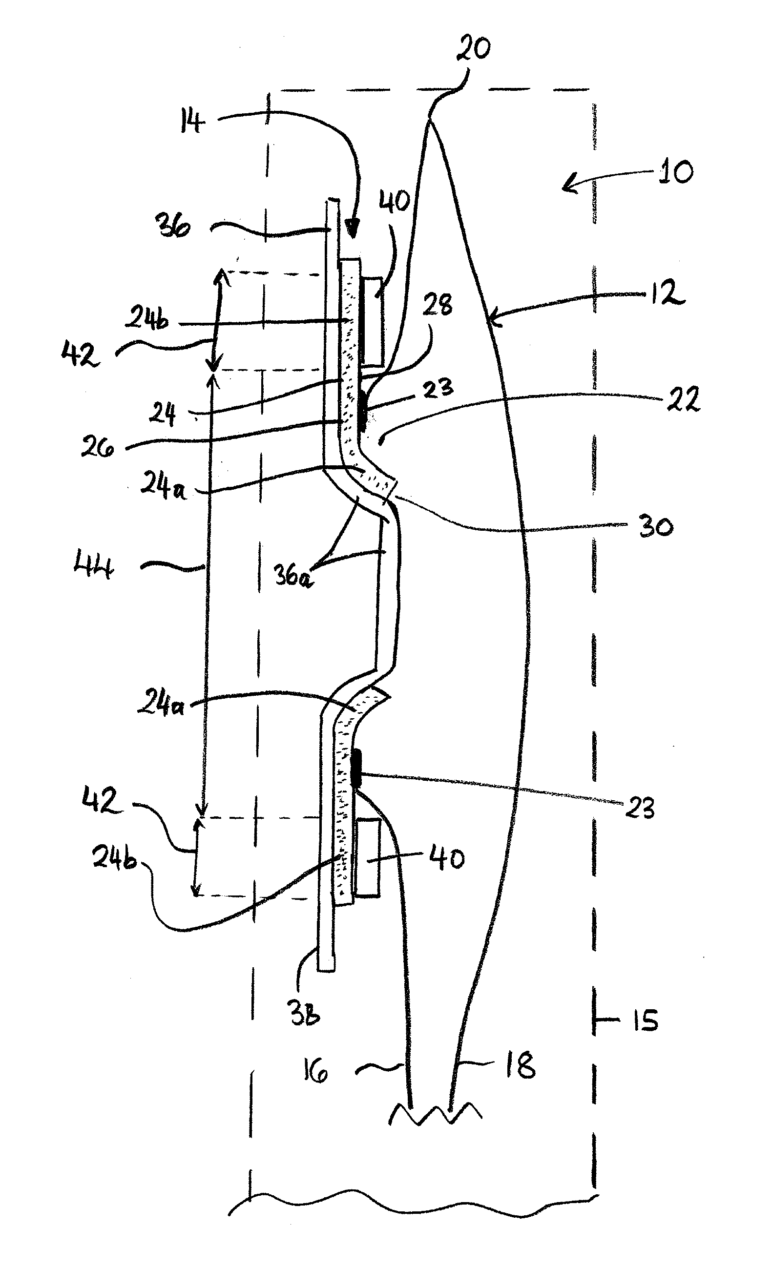 Adhesive body fitment for ostomy appliane