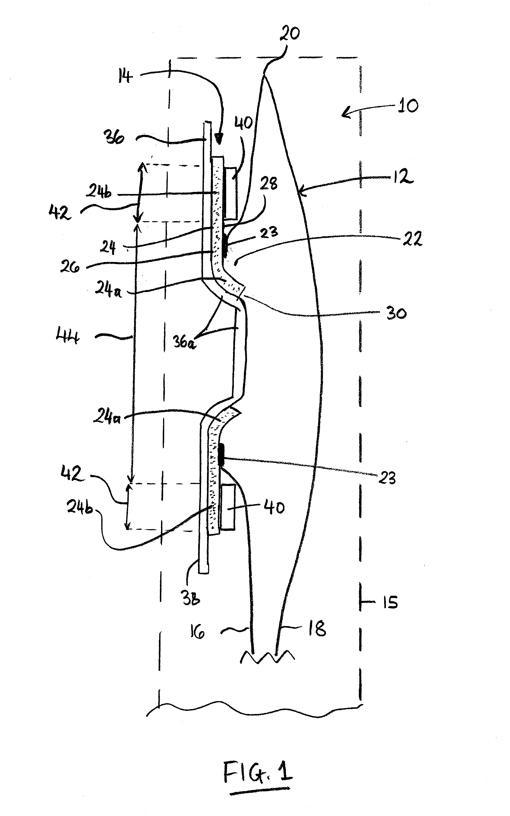 Adhesive body fitment for ostomy appliane