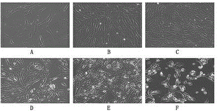 Stem cell preparation for resisting malignant melanoma and preparation method of stem cell preparation