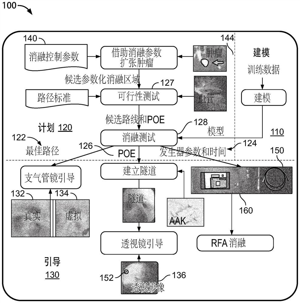 Image-guided lung tumor planning and ablation system