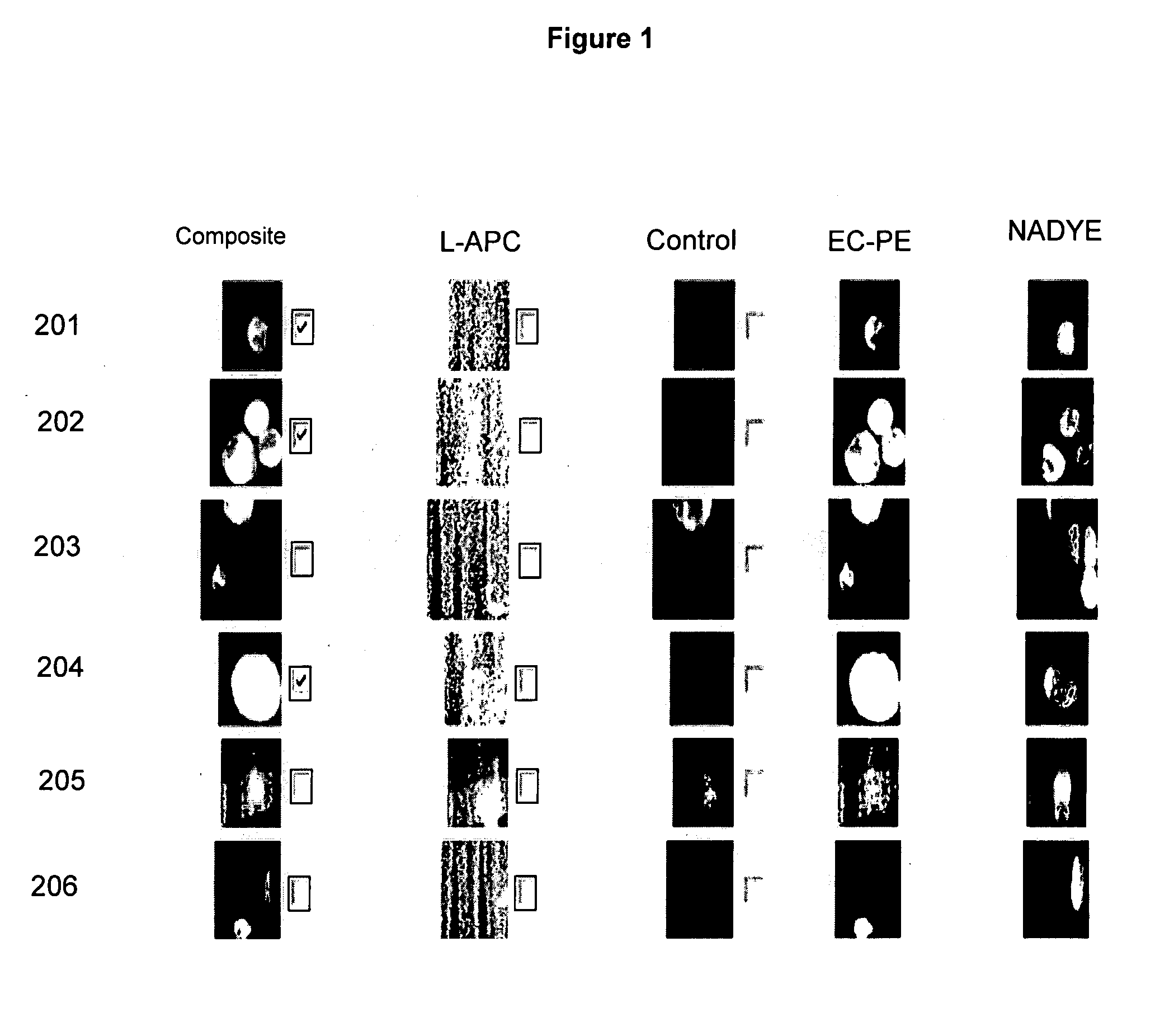 Method for predicting progression free and overall survival at each follow-up time point during therapy of metastatic breast cancer patients using circulating tumor cells