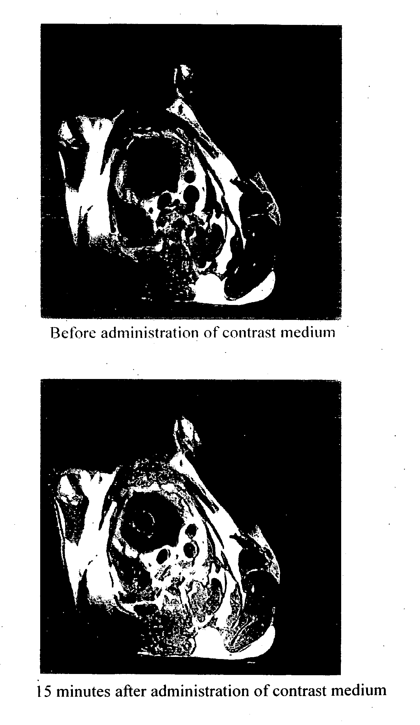 Glycerophosphoric acid ester derivative having polyfunctional metal chelate structure