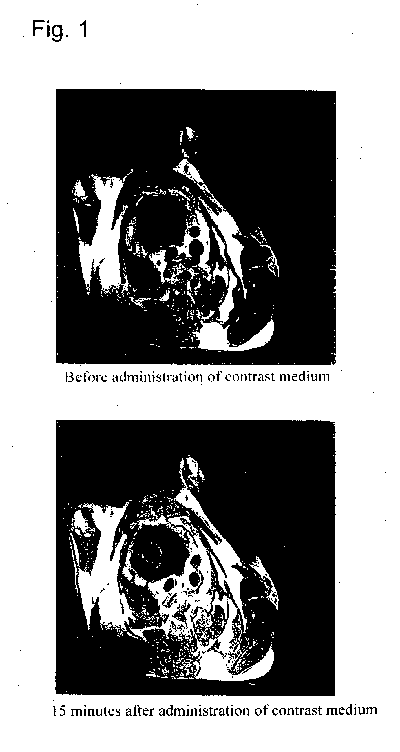 Glycerophosphoric acid ester derivative having polyfunctional metal chelate structure