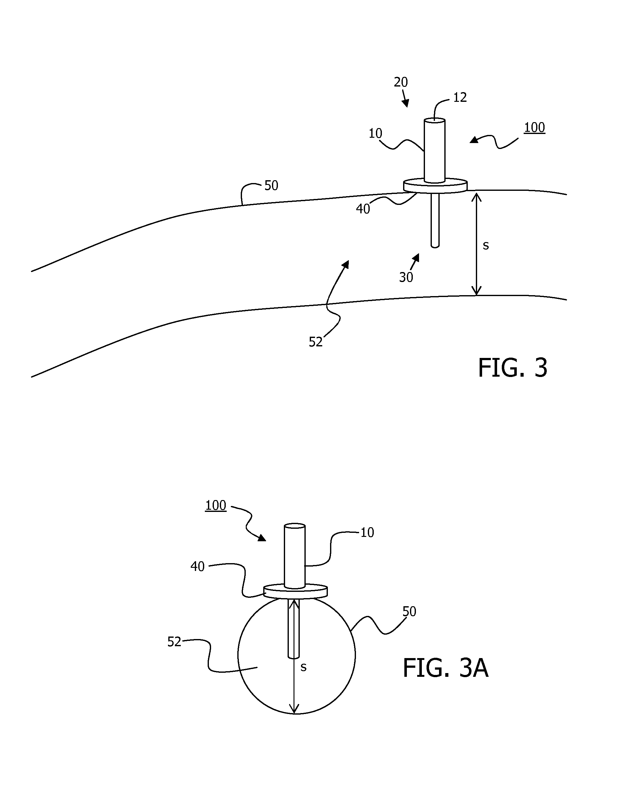 Minimally-advancing luminal catheter