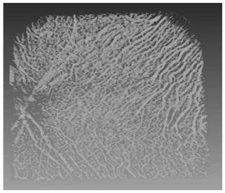 Choroid three-dimensional blood vessel imaging and quantitative analysis method and device based on optical coherence tomography system