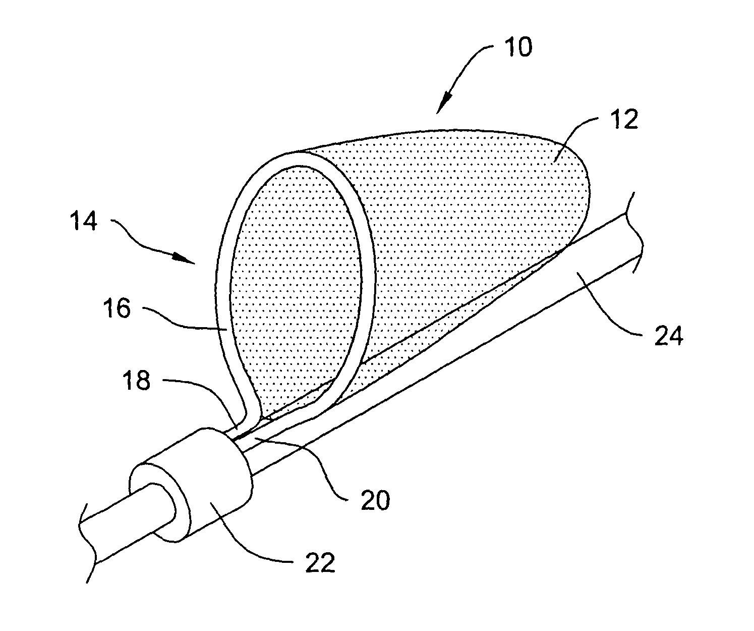 Selective treatment of linear elastic materials to produce localized areas of superelasticity