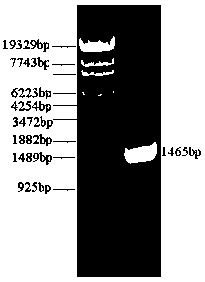 A strain of genetically engineered bacteria that produces l-aspartic acid by fermentation