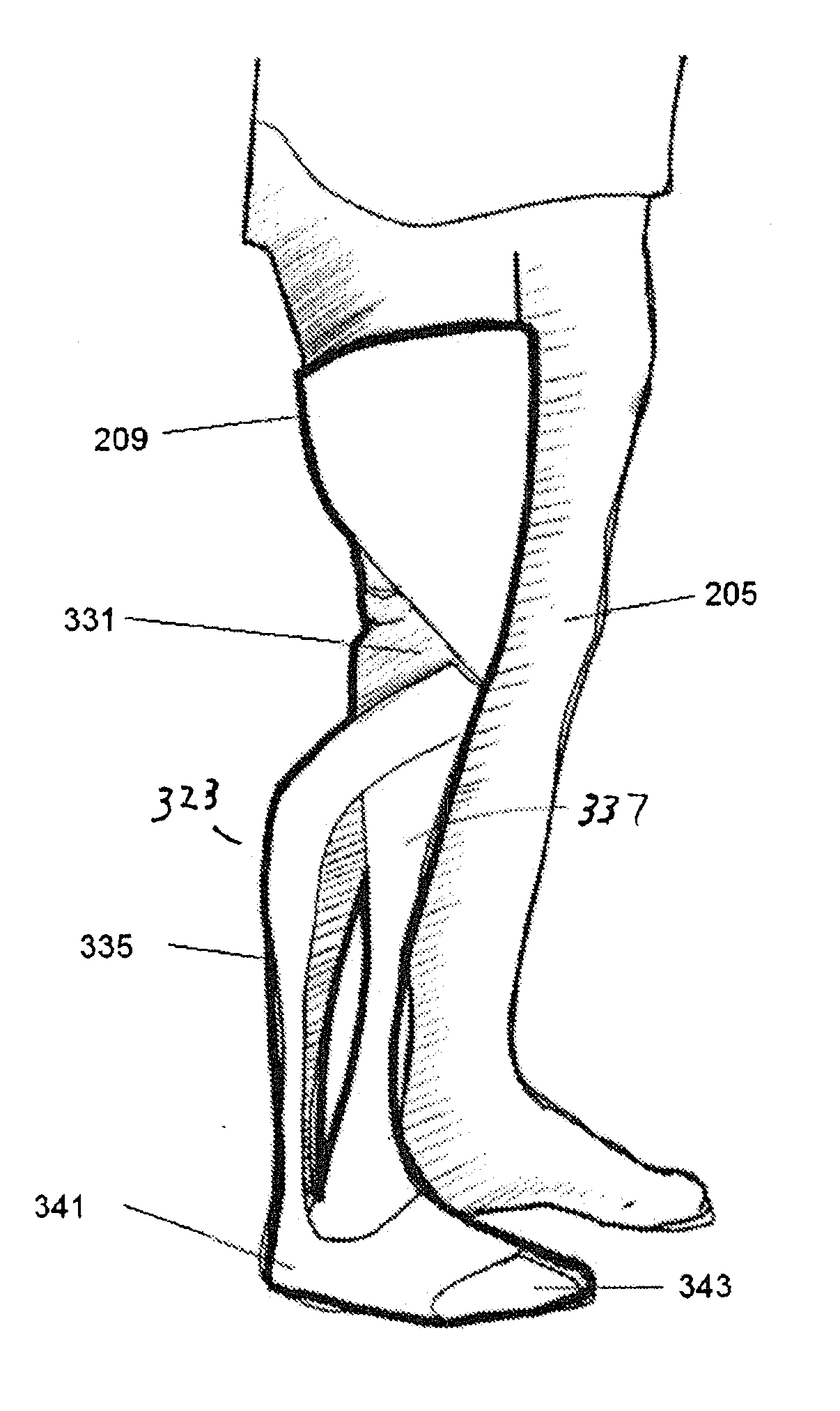 Prosthetic limb