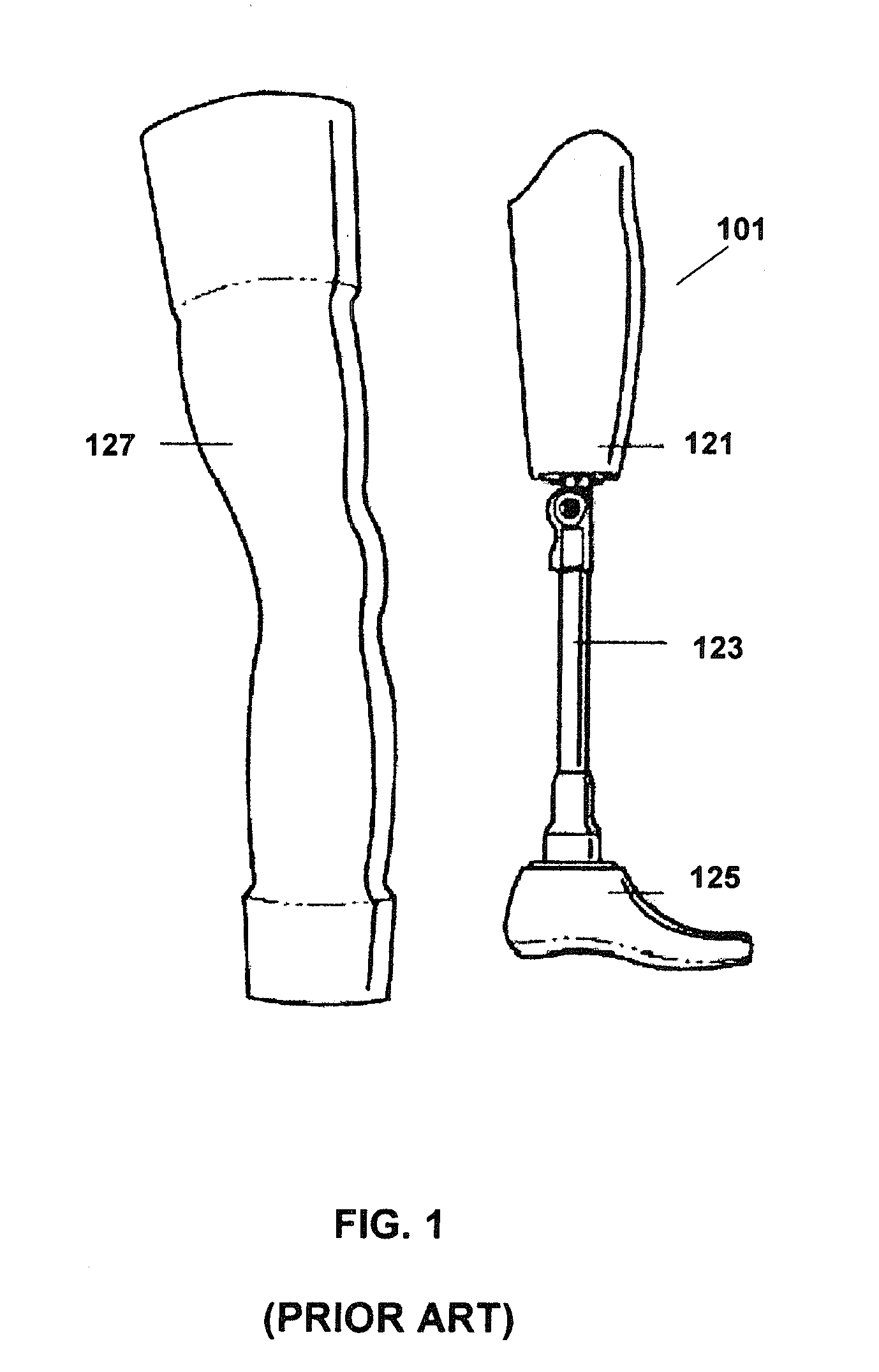 Prosthetic limb