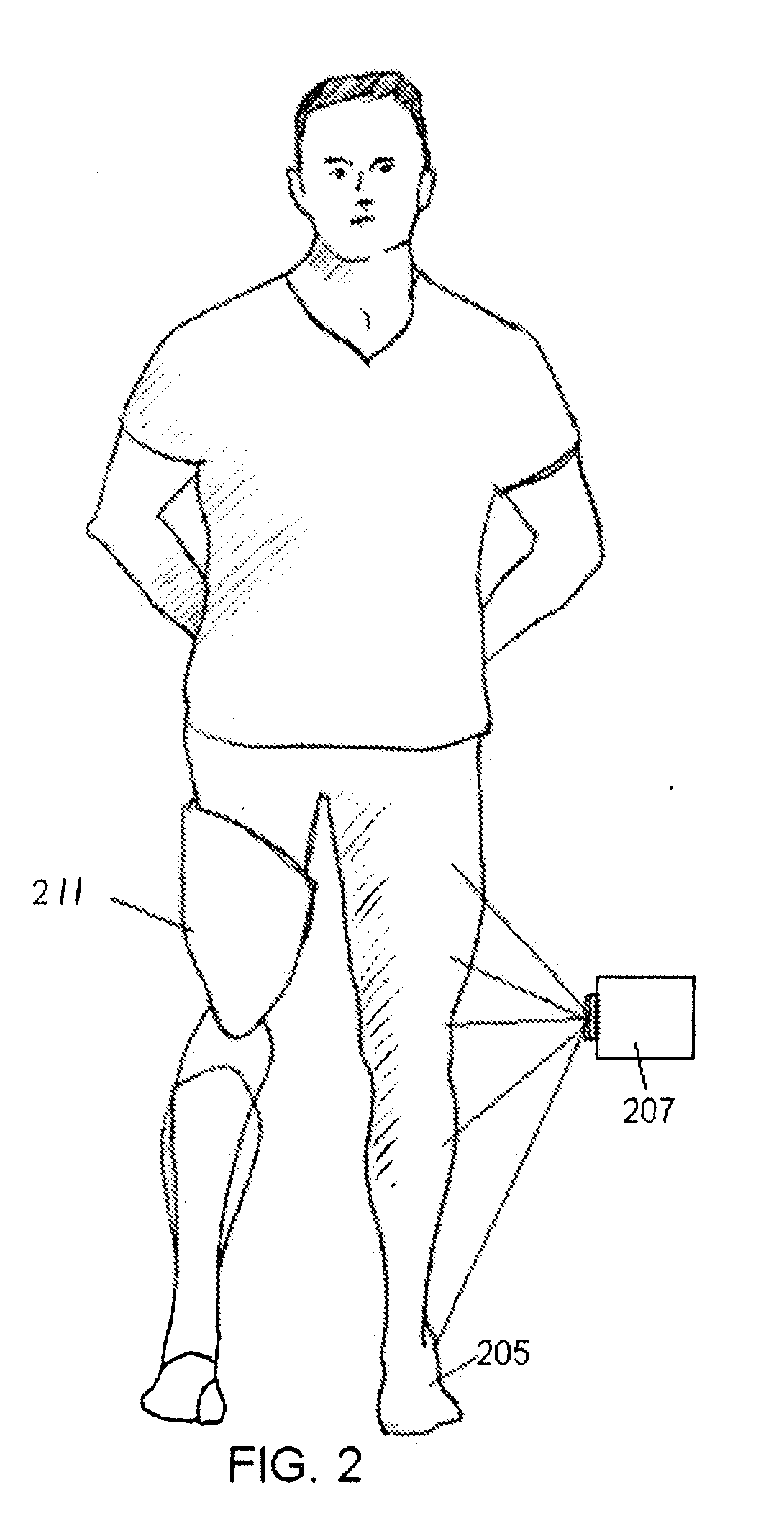 Prosthetic limb