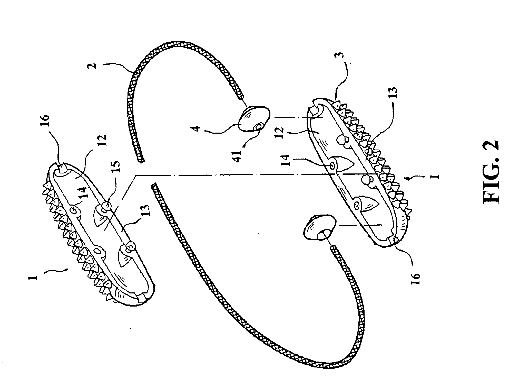 Handheld palm acupressure apparatus