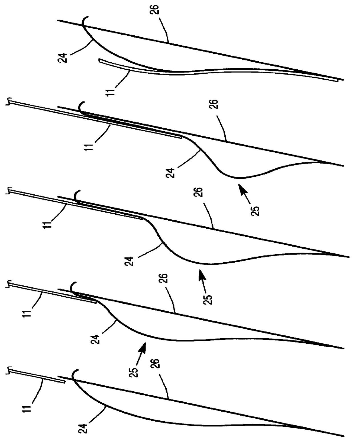 Apparatus and method of automatically adjusting a document deceleration rate