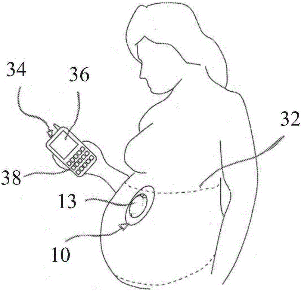 Fetal movement monitor