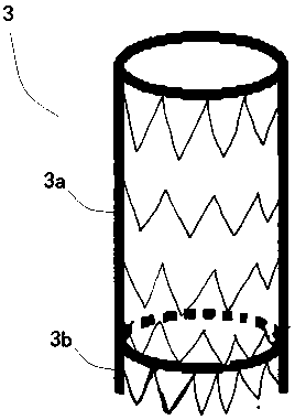 Novel aortic-arch vascular assembly with branch covered stents