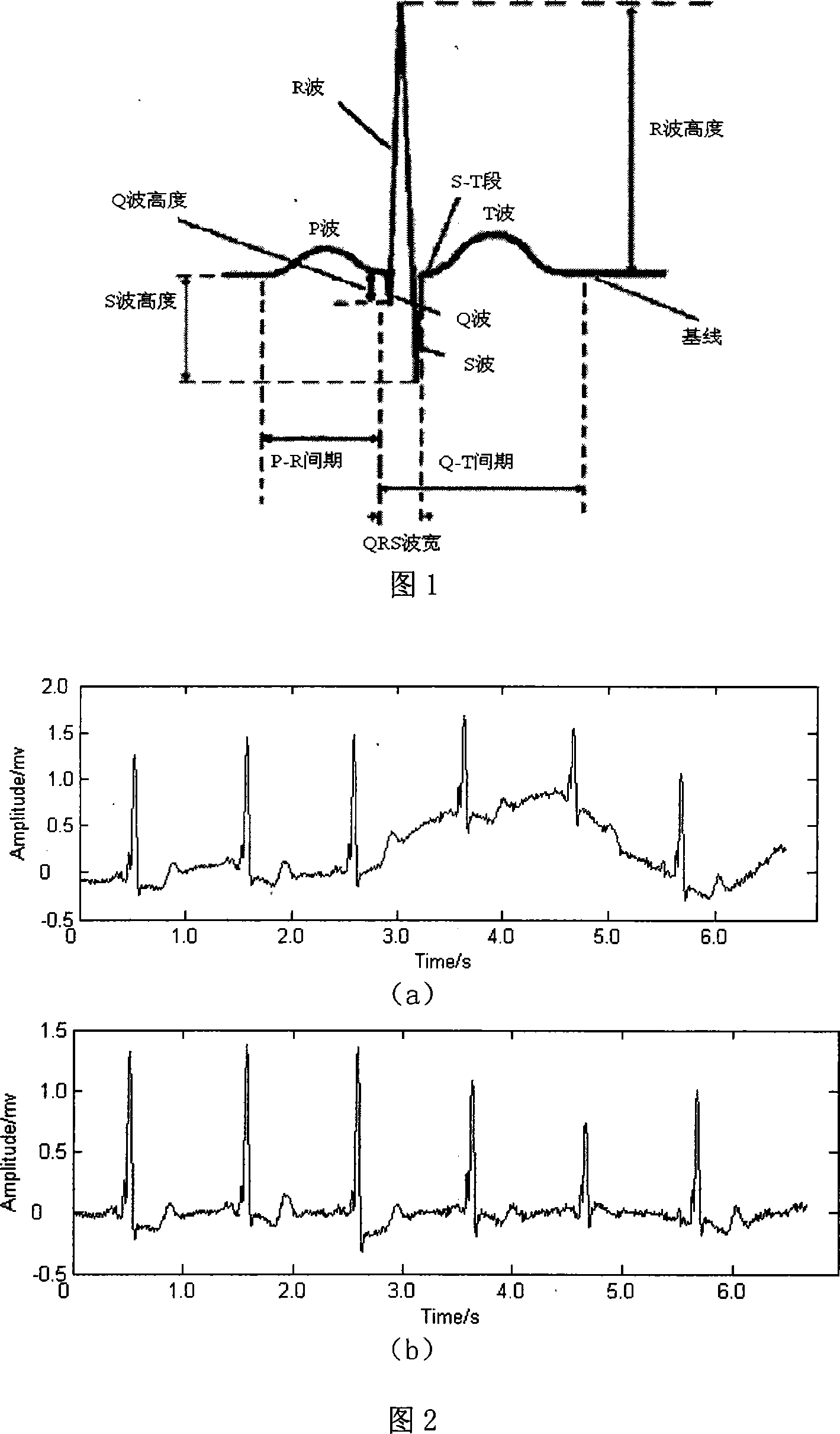 Cardioelectric characteristic extracting process based on evolutive wavelet wiener deconvolution