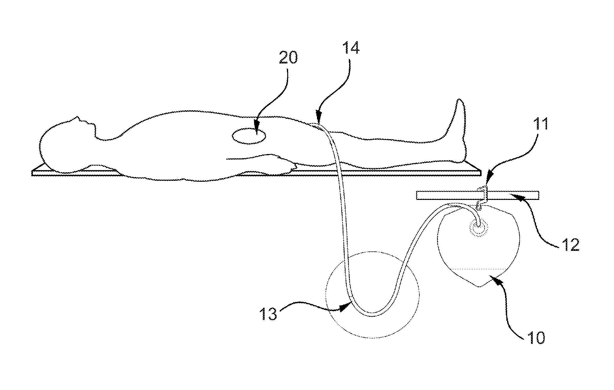 Context-sensitive flow interrupter and drainage outflow optimization system