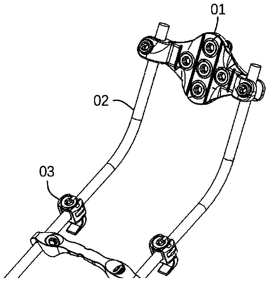 Occipital bone plate system