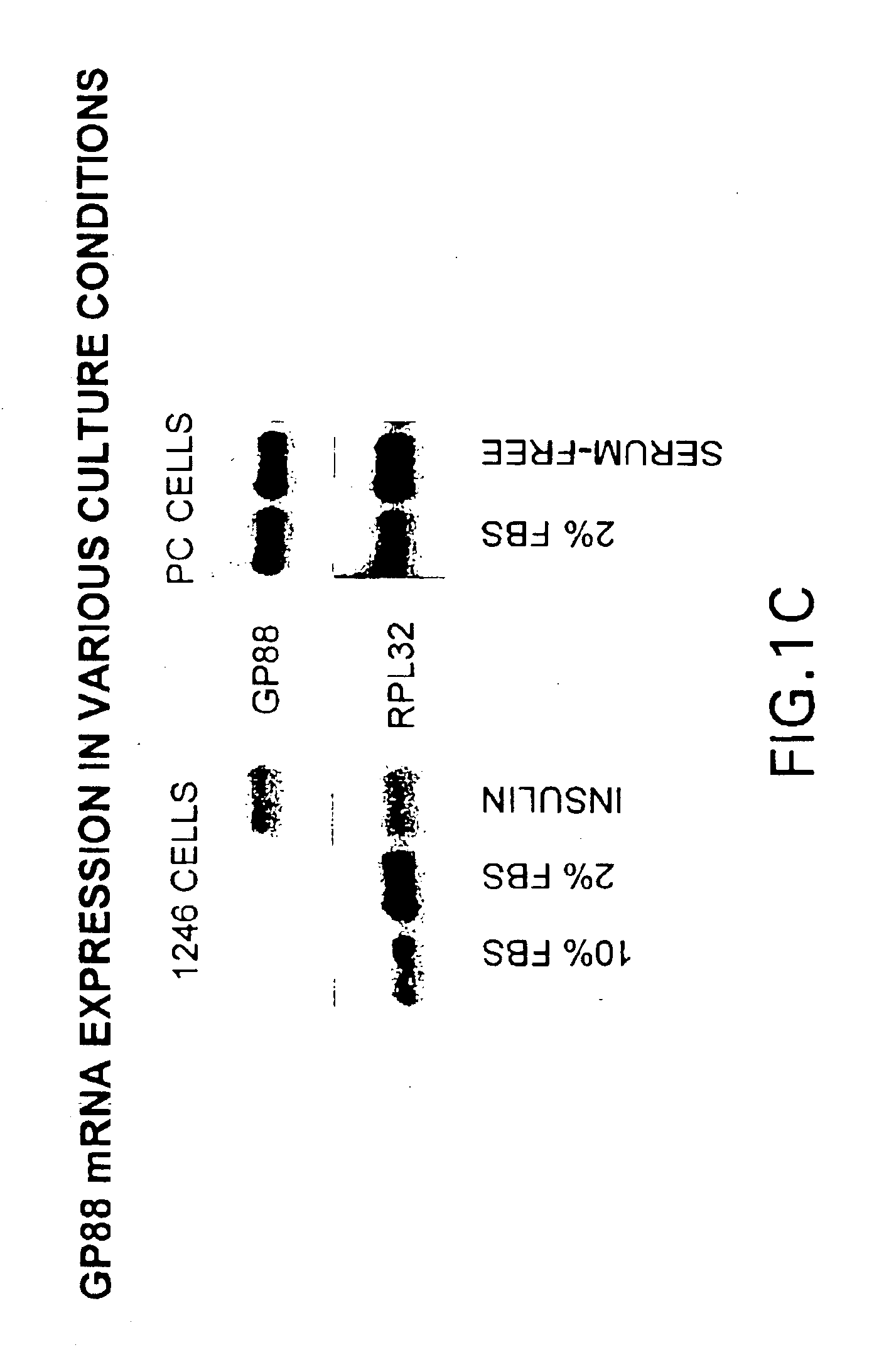 Methods and kits for diagnosing tumorigenicity and determining resistance to the antineoplastic effects of antiestrogen therapy