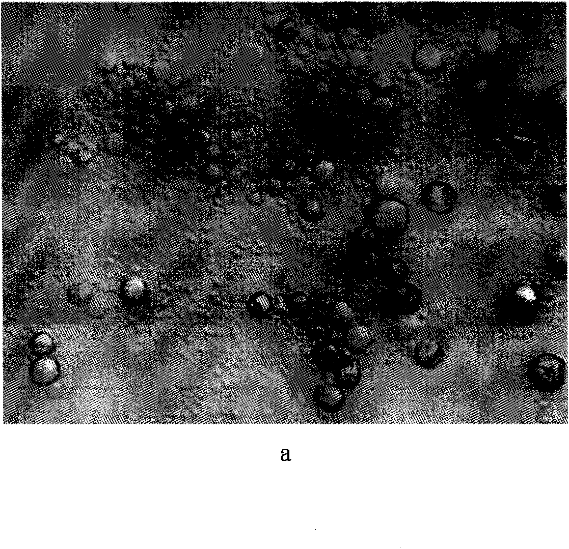 Polyurea-melamin resin double-wall material cetane microcapsule and preparation method thereof