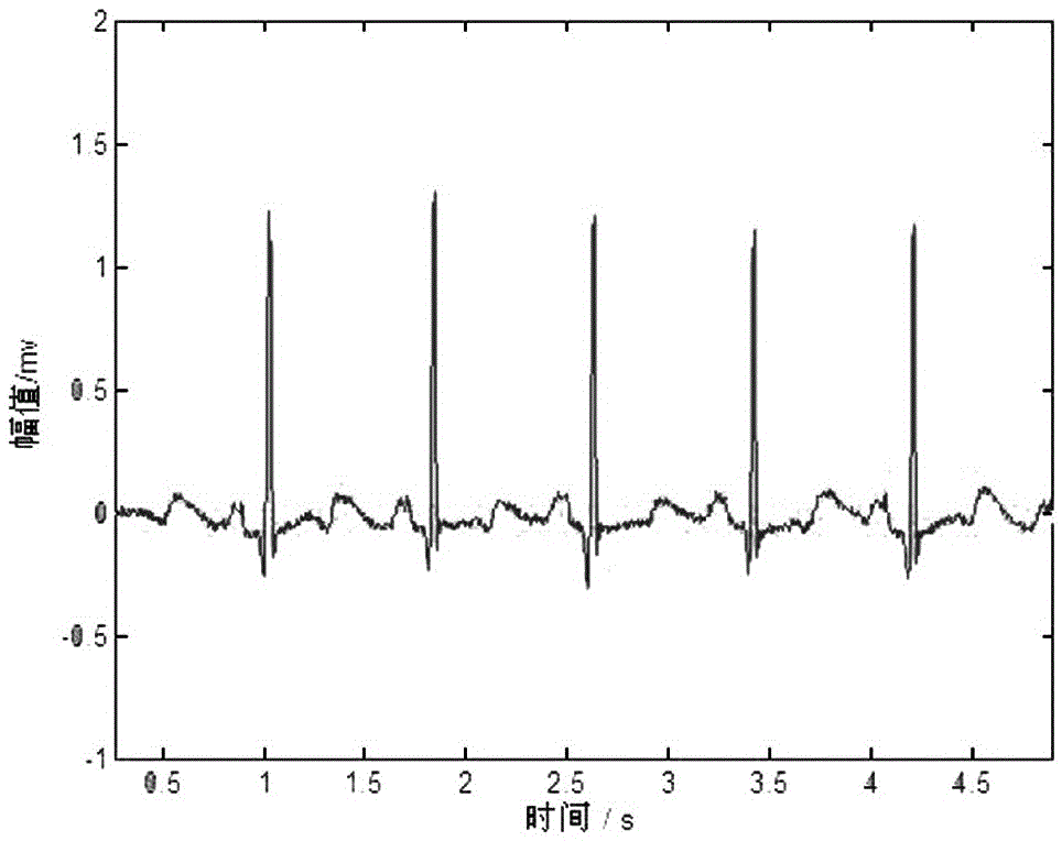 A method for automatic classification of ECG signals