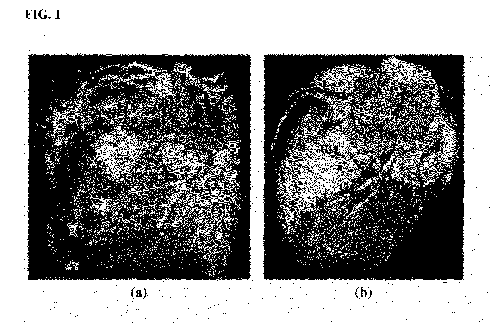 Method and System for Heart Isolation in Cardiac Computed Tomography Volumes for Patients with Coronary Artery Bypasses