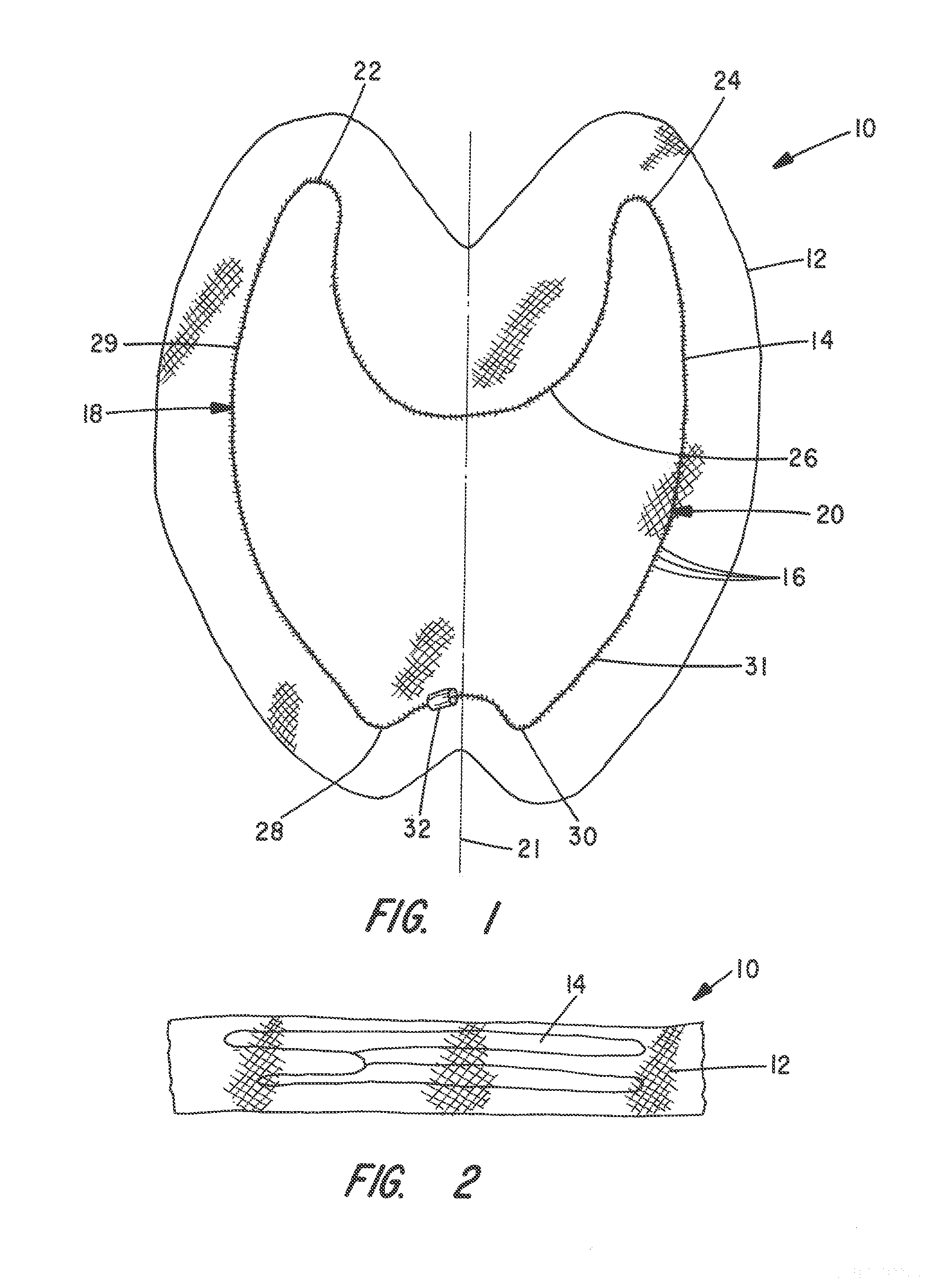 Apparatus and Method for Pelvic Floor Repair in the Human Female