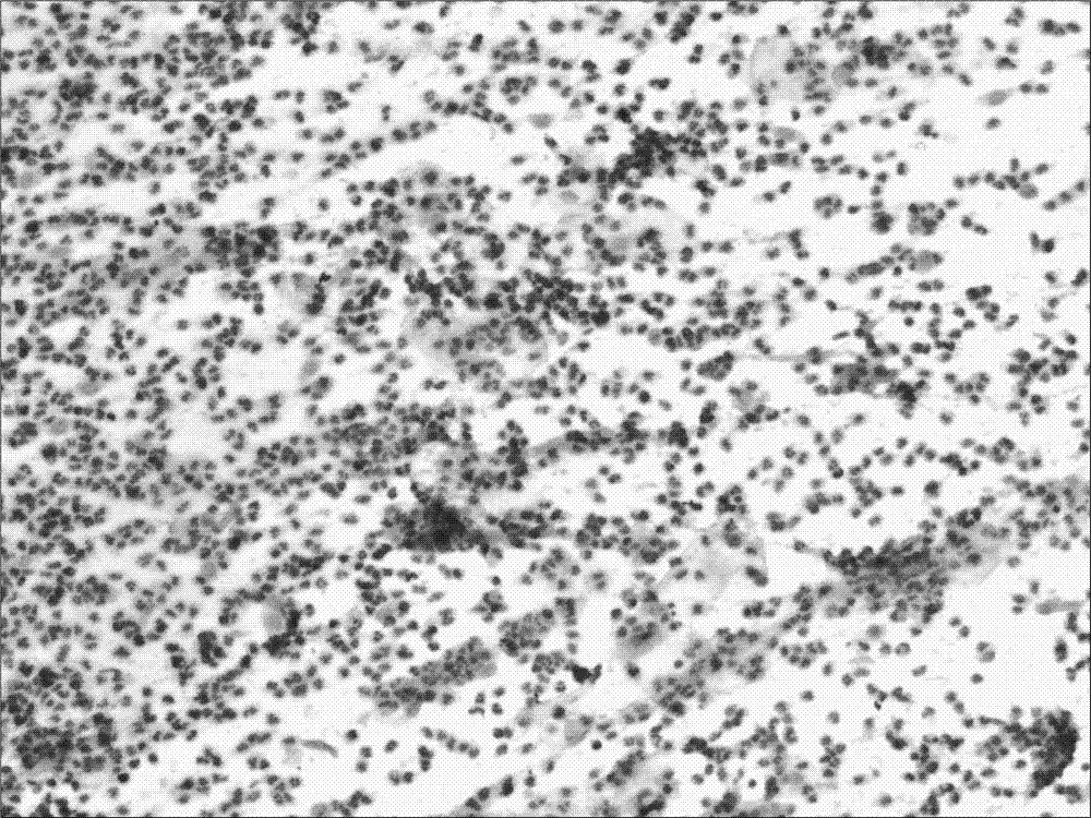 Pathological diagnosis kit, and rapid processing technology for tissue slices