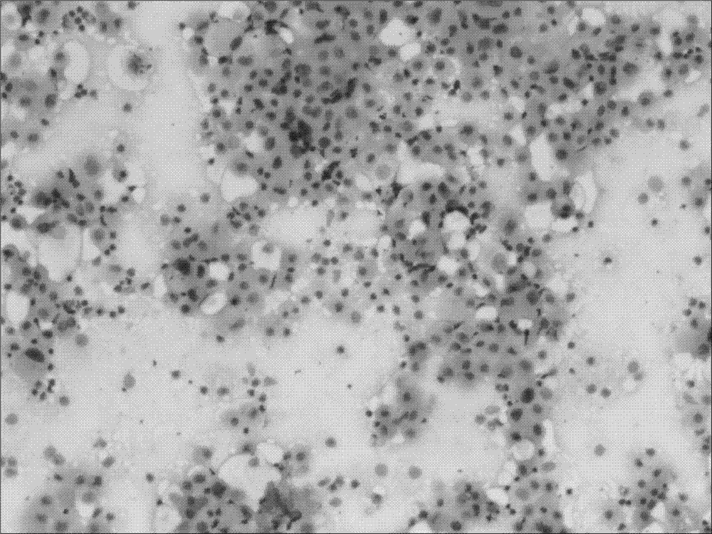 Pathological diagnosis kit, and rapid processing technology for tissue slices