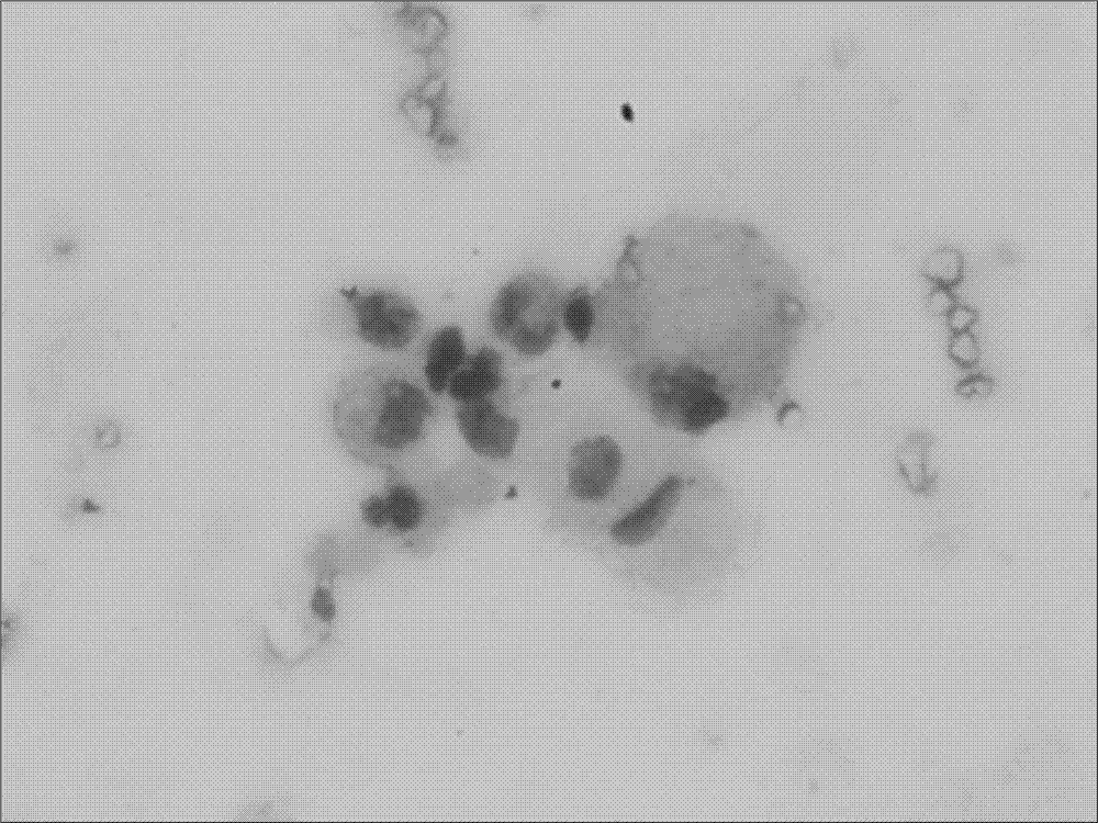 Pathological diagnosis kit, and rapid processing technology for tissue slices