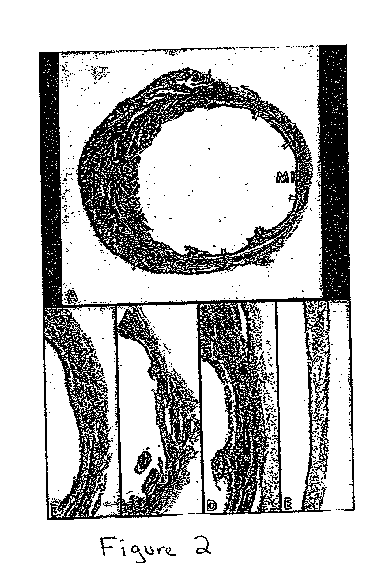 Methods and compositions for the repair and/or regeneration of damaged myocardium