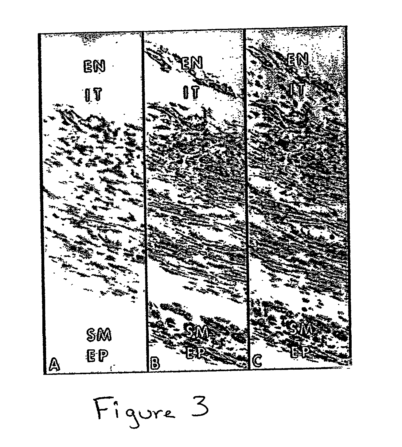 Methods and compositions for the repair and/or regeneration of damaged myocardium