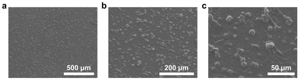 Asymmetric semi-solid electrolyte, preparation method and metal lithium secondary battery