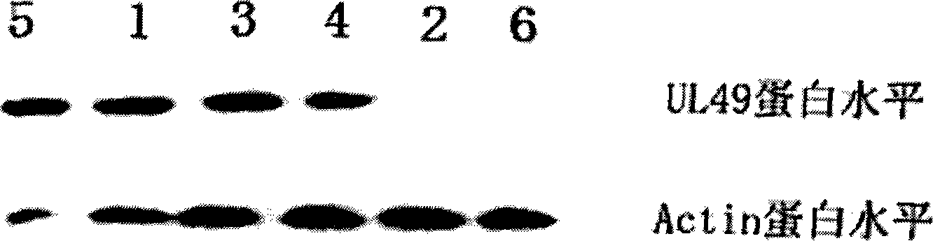 External leader sequence for guiding RNase P ribozyme and use thereof in anti-HCMV medicament preparation