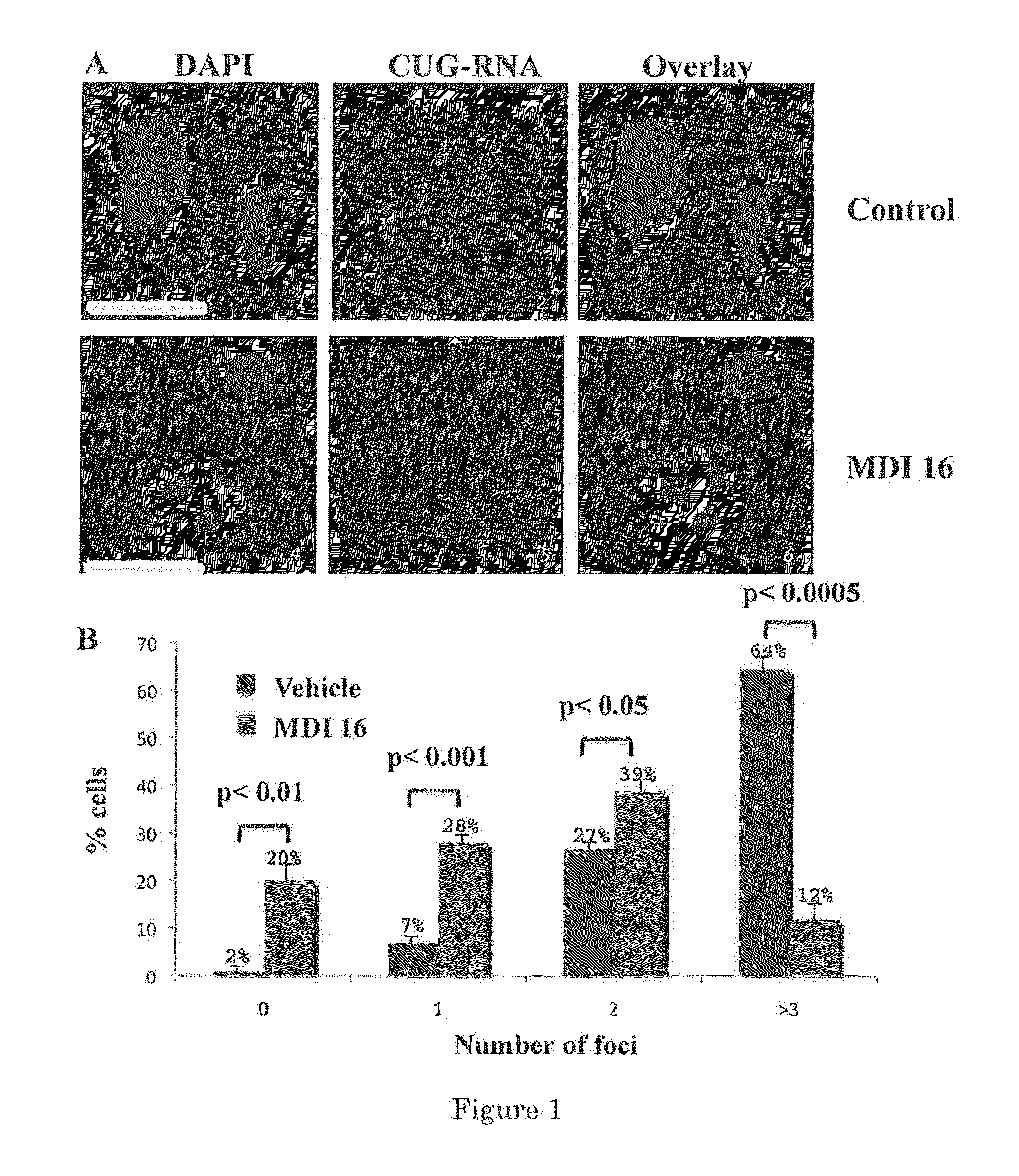 Compositions and Methods for Treating Myotonic Dystrophy Type 1