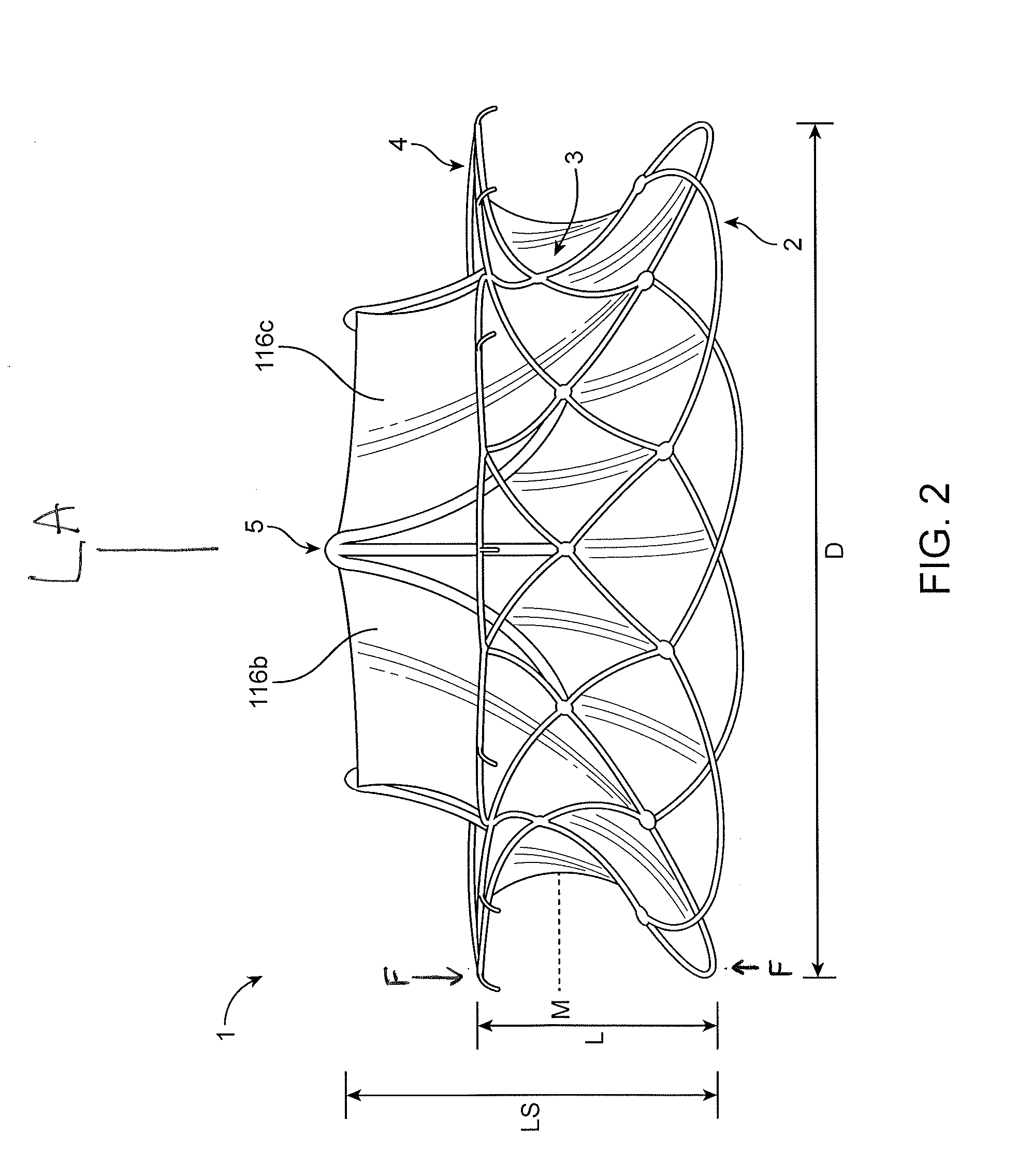 Replacement cardiac valves and methods of use and manufacture