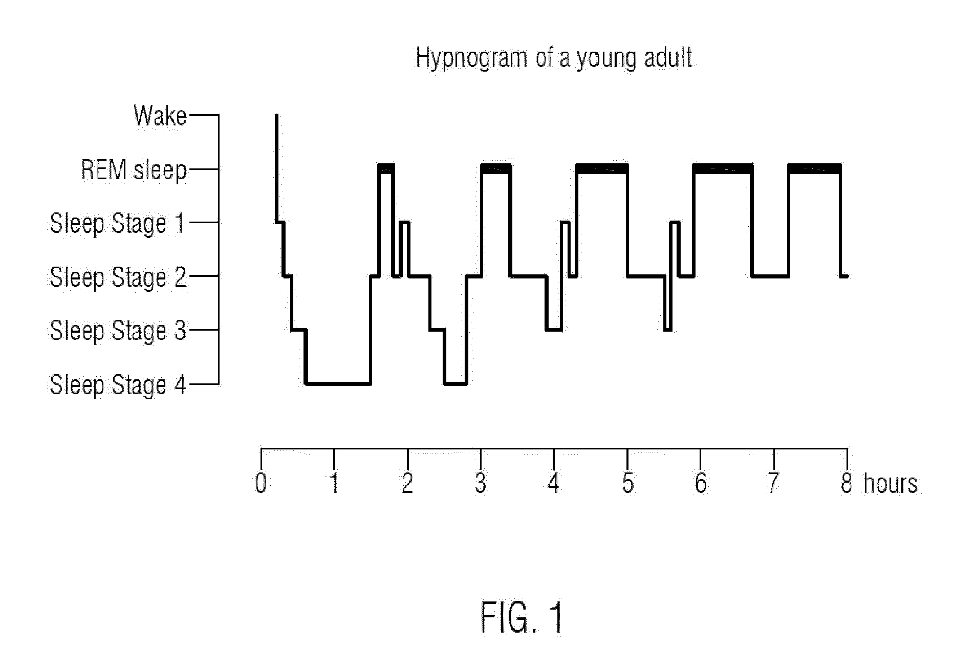 System and method for determining sleep and sleep stages of a person