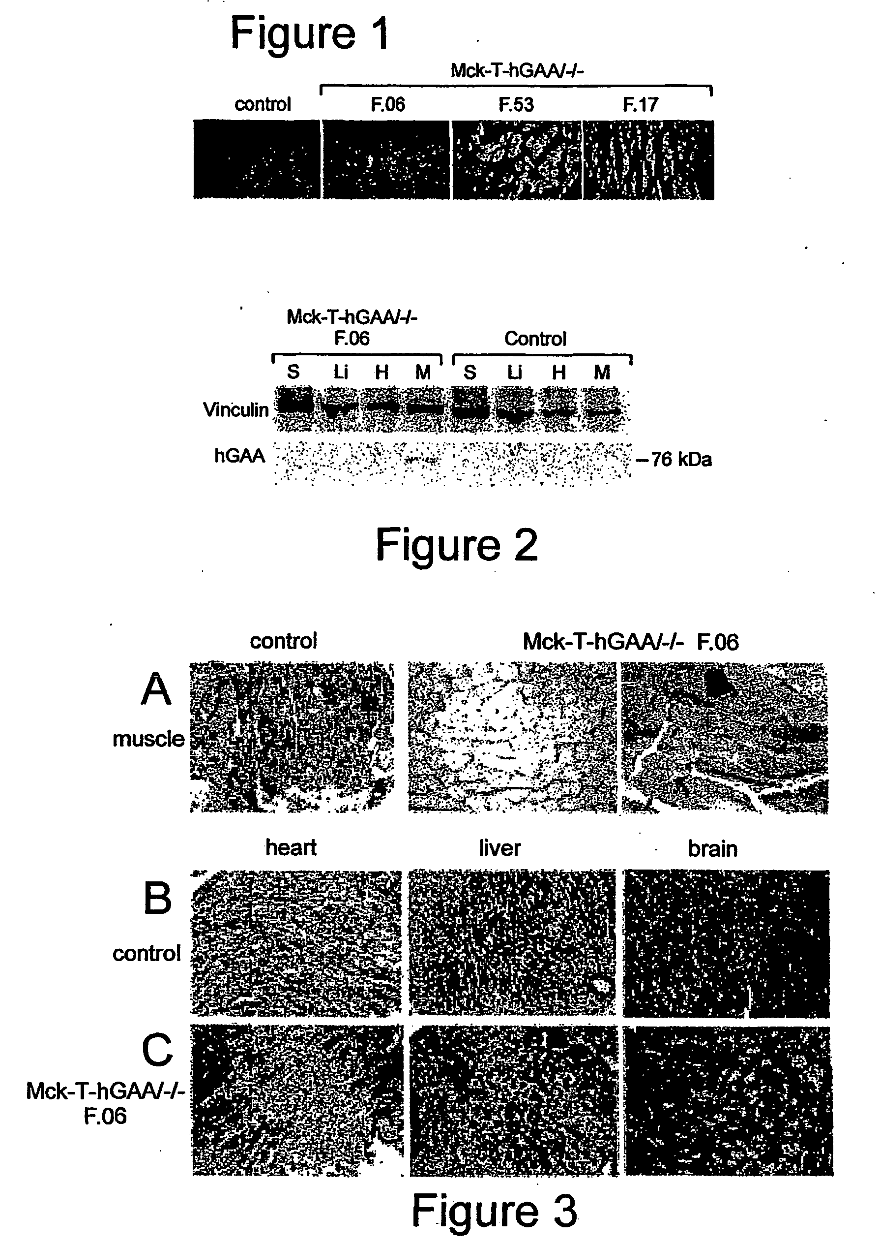 Synthesis and secretion of native recombinant lysosomal enzymes by liver