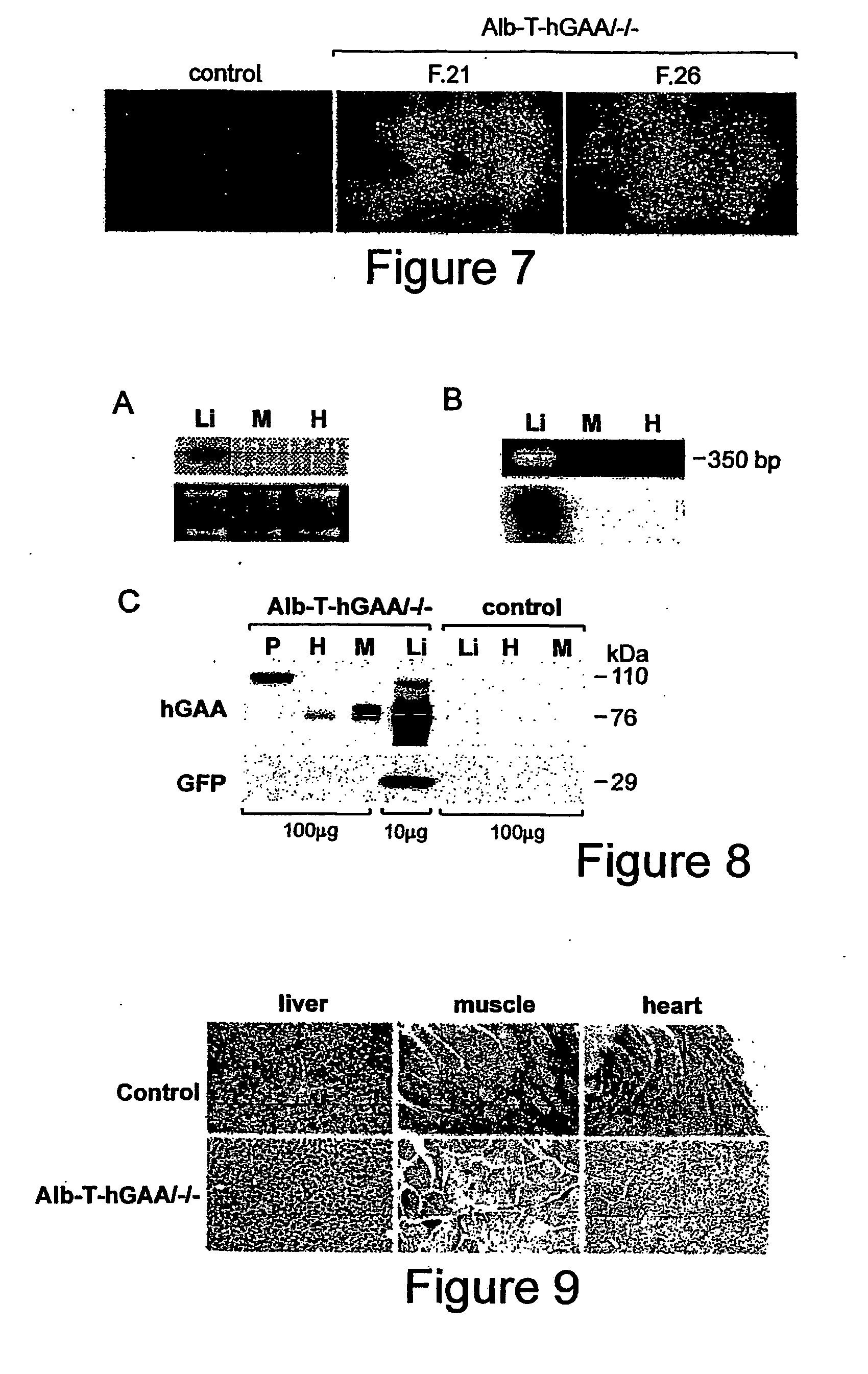 Synthesis and secretion of native recombinant lysosomal enzymes by liver