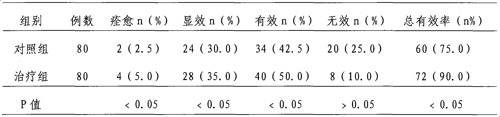 Medicine for treating calculus and preparation method thereof