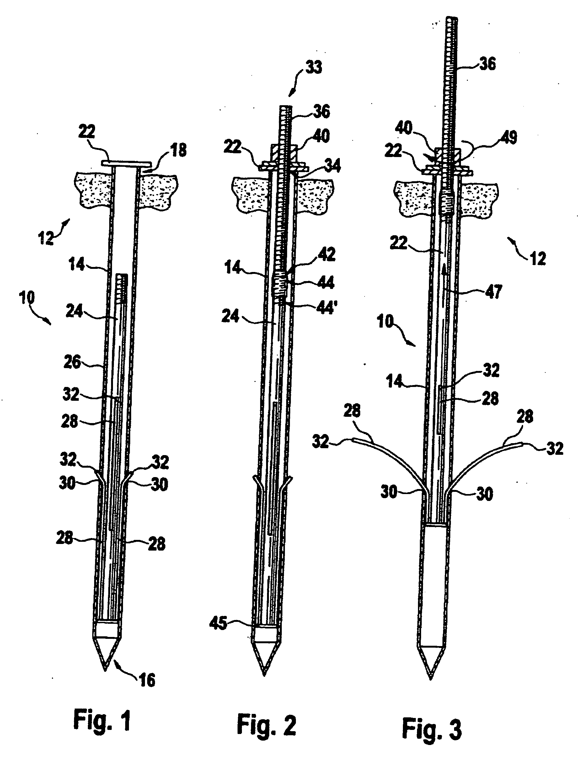 System for fixing an object in the ground by means of a peg