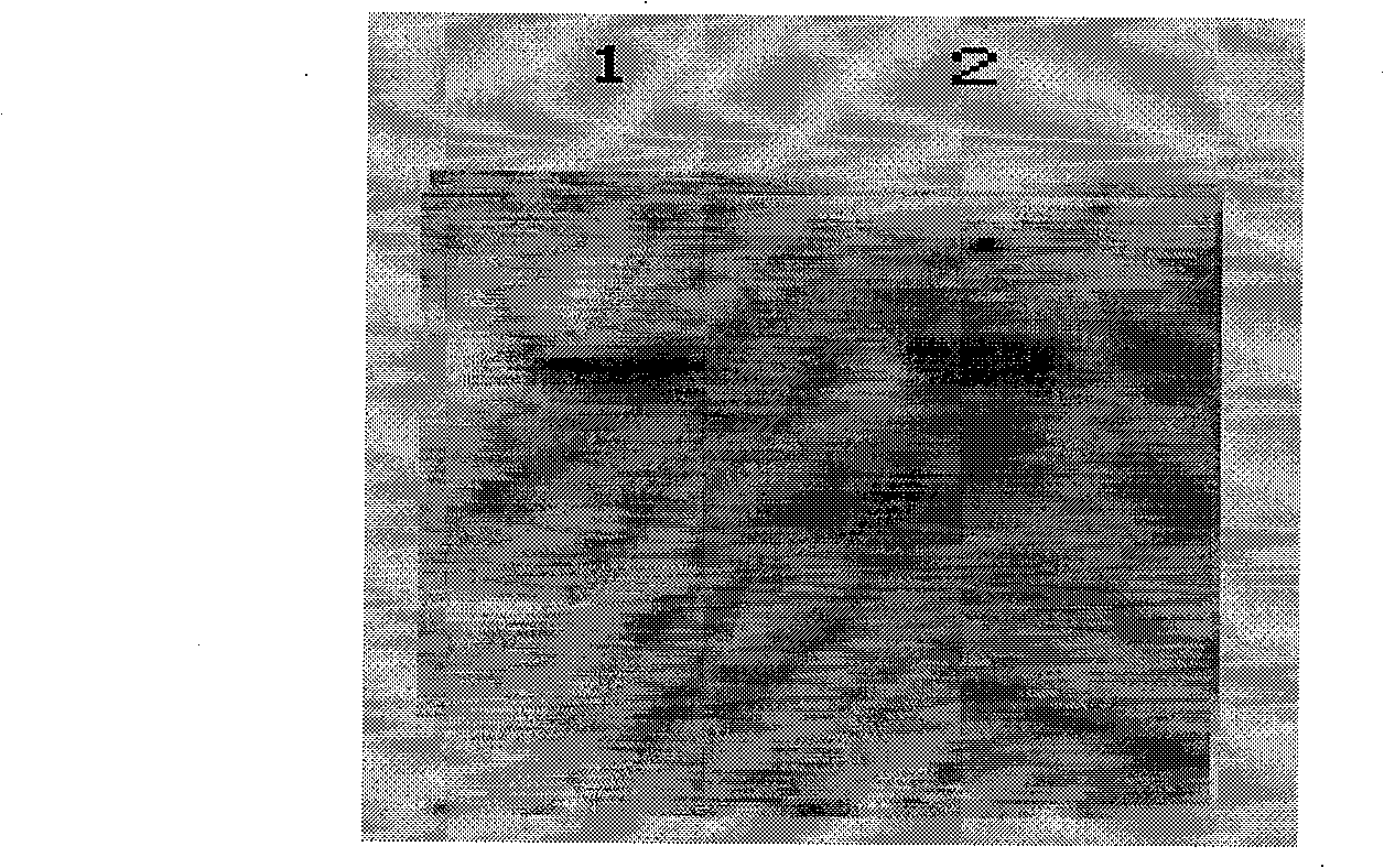 Yeast proliferation model of human papilloma virus as well as constructing method and uses