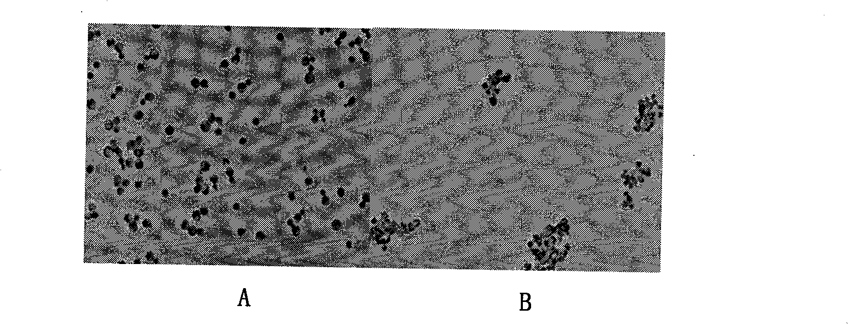 Yeast proliferation model of human papilloma virus as well as constructing method and uses