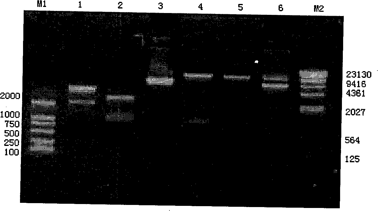 Yeast proliferation model of human papilloma virus as well as constructing method and uses